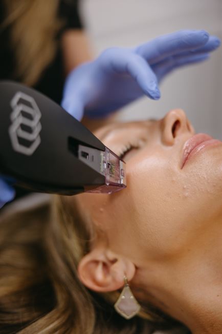 Morpheus8 1 Area Package of 2 Treatments
