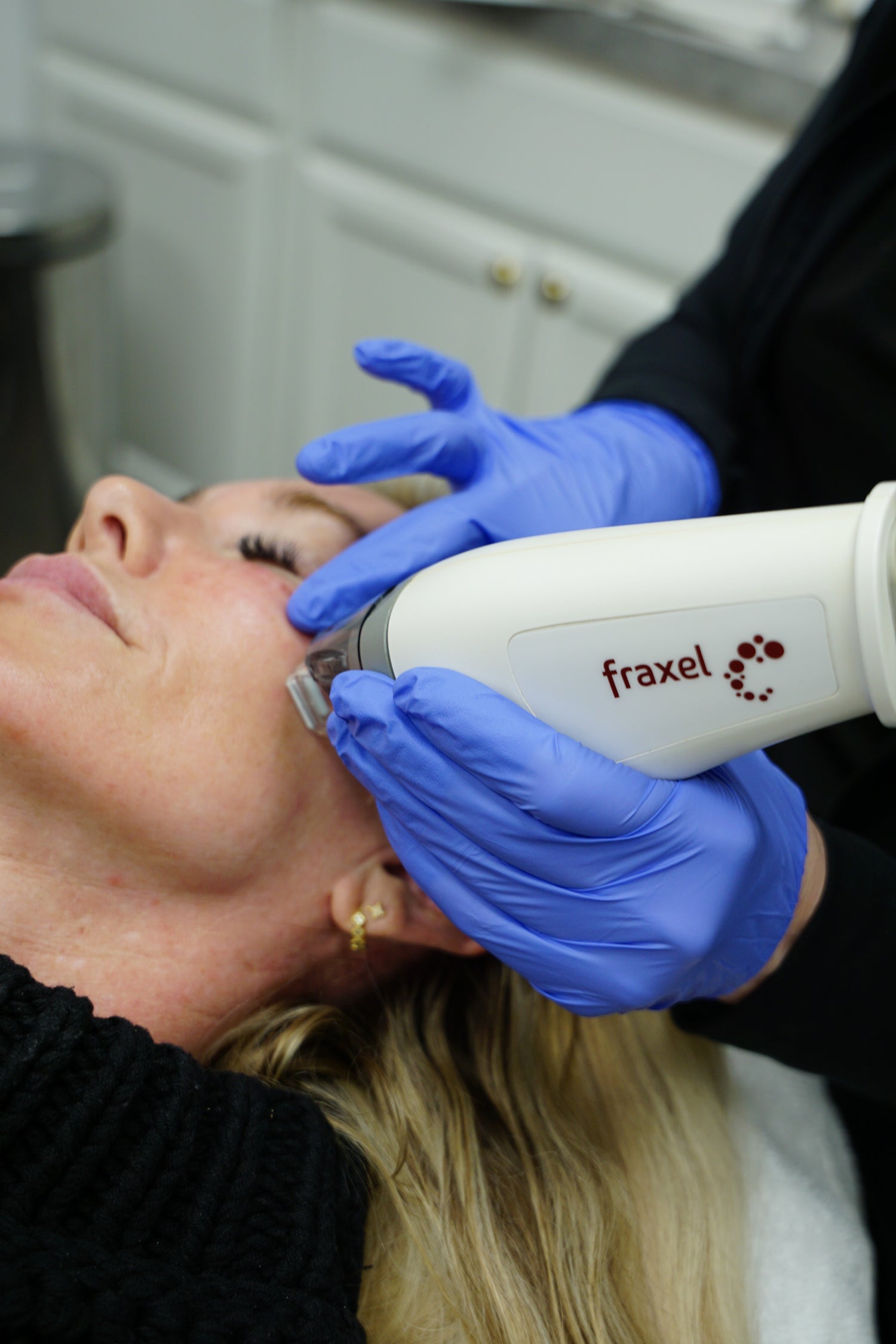 Fraxel Package of 3 Treatments