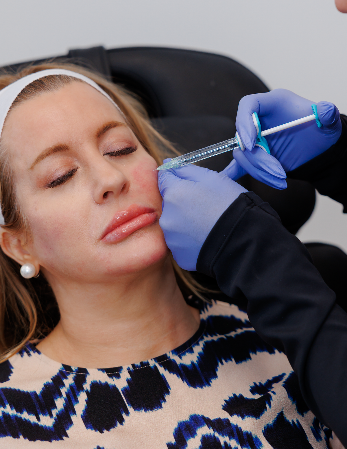 Full Facial Balancing | Holistic Facial Rejuvenation