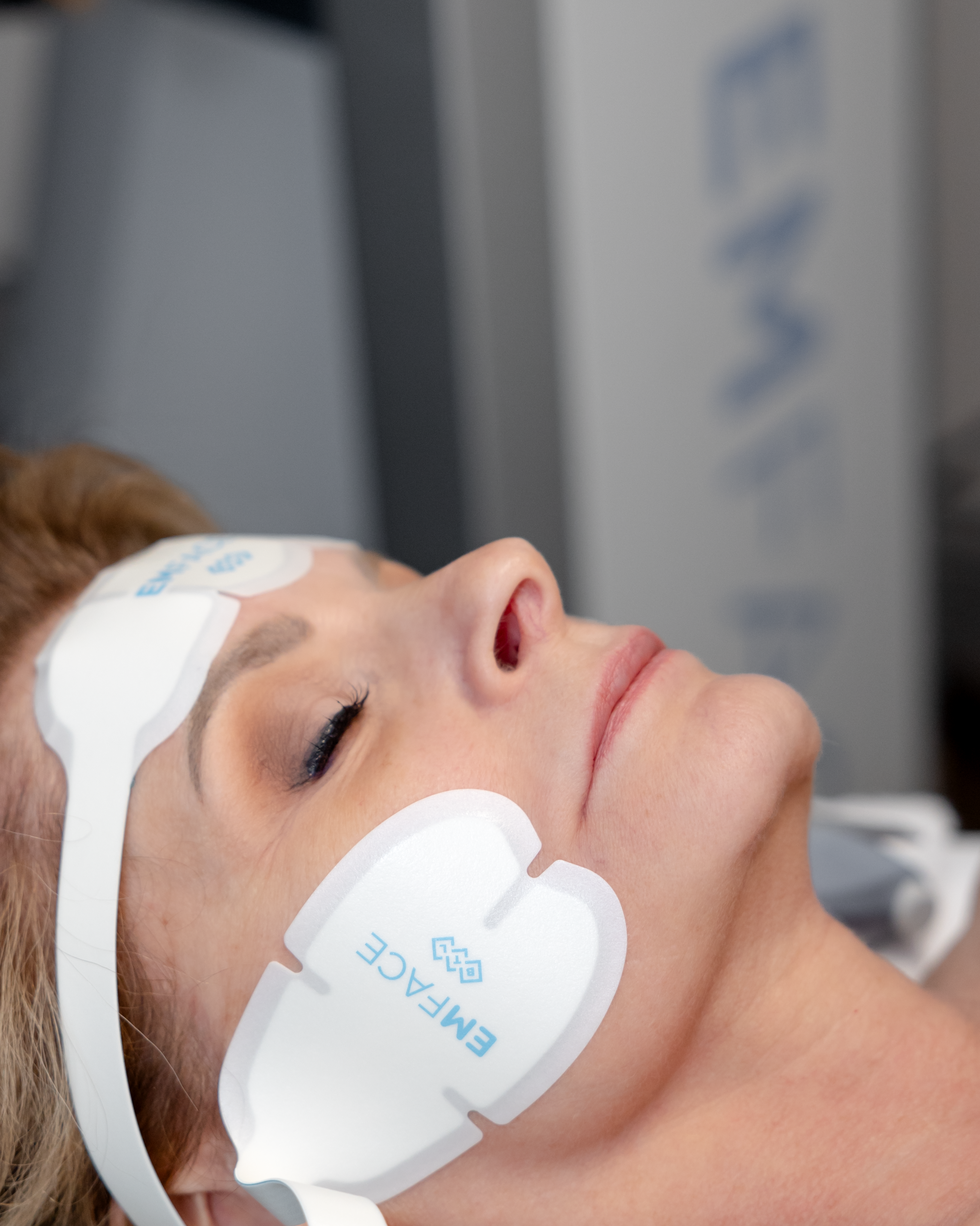 EmFace Submental Package of 4 Treatments