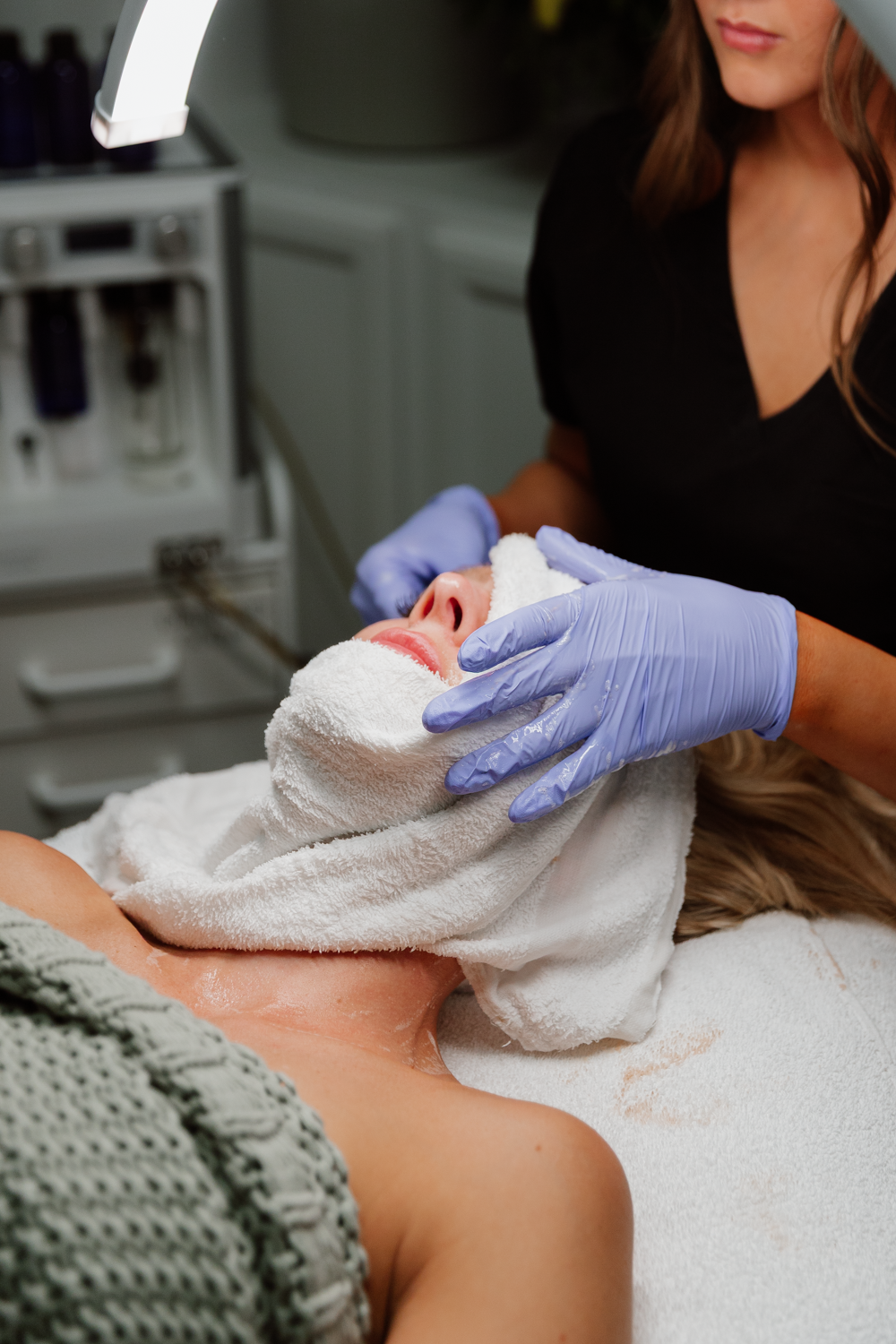 VI Peel Precision Plus Single Treatment