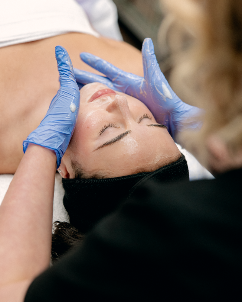 Microdermabrasion Package of 5 Treatments