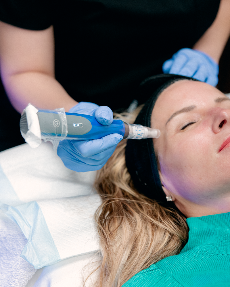 SkinPen Package of 3 Treatments