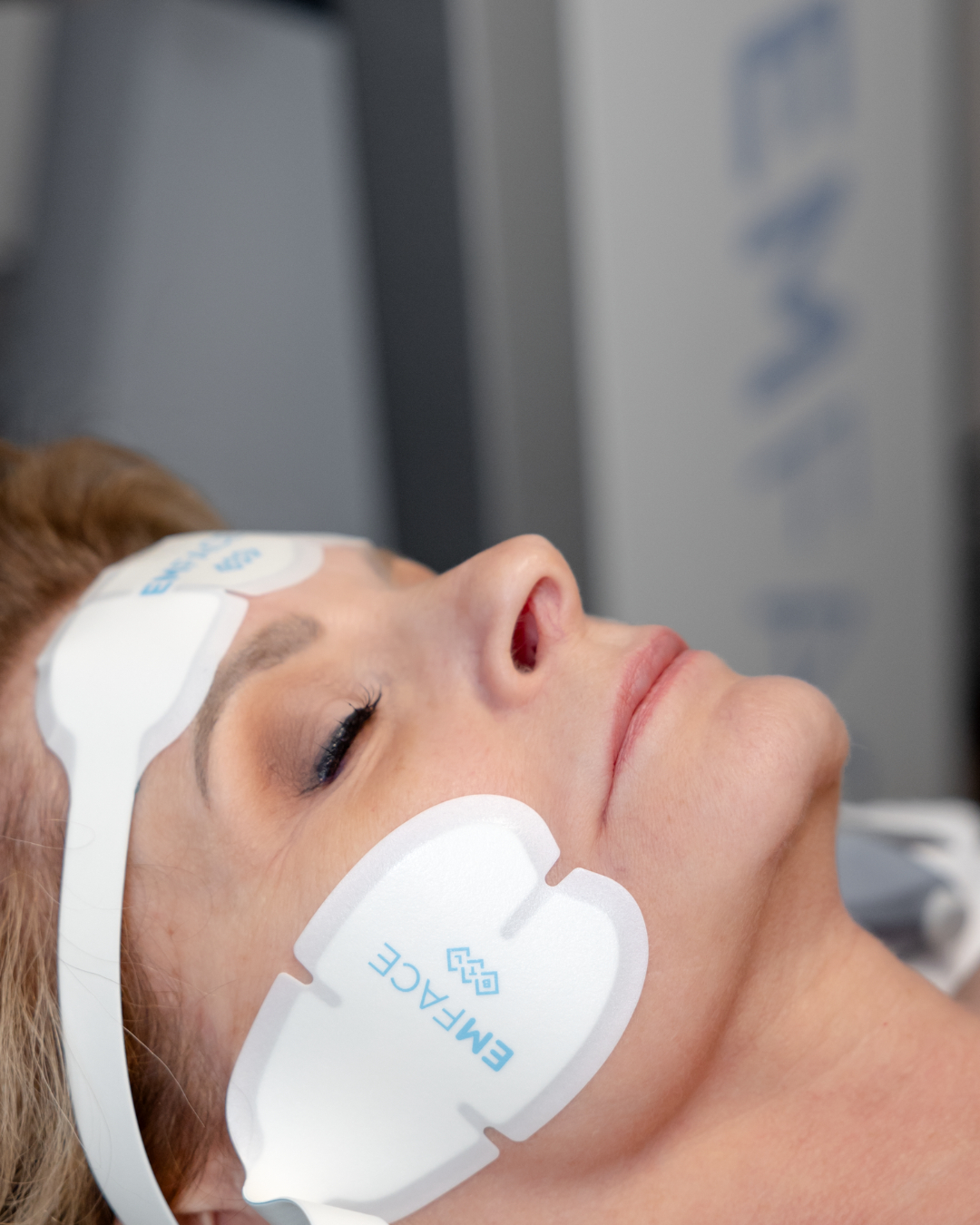 EmFace 2 Areas Single Treatment