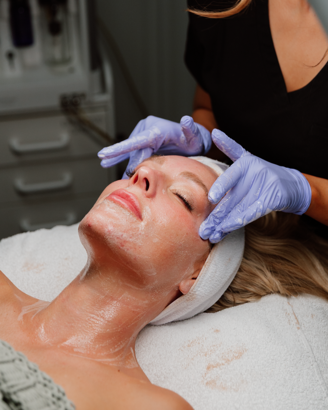 NON-TCA (Lactic, Glycolic, Salicylic) Peel Single Treatment