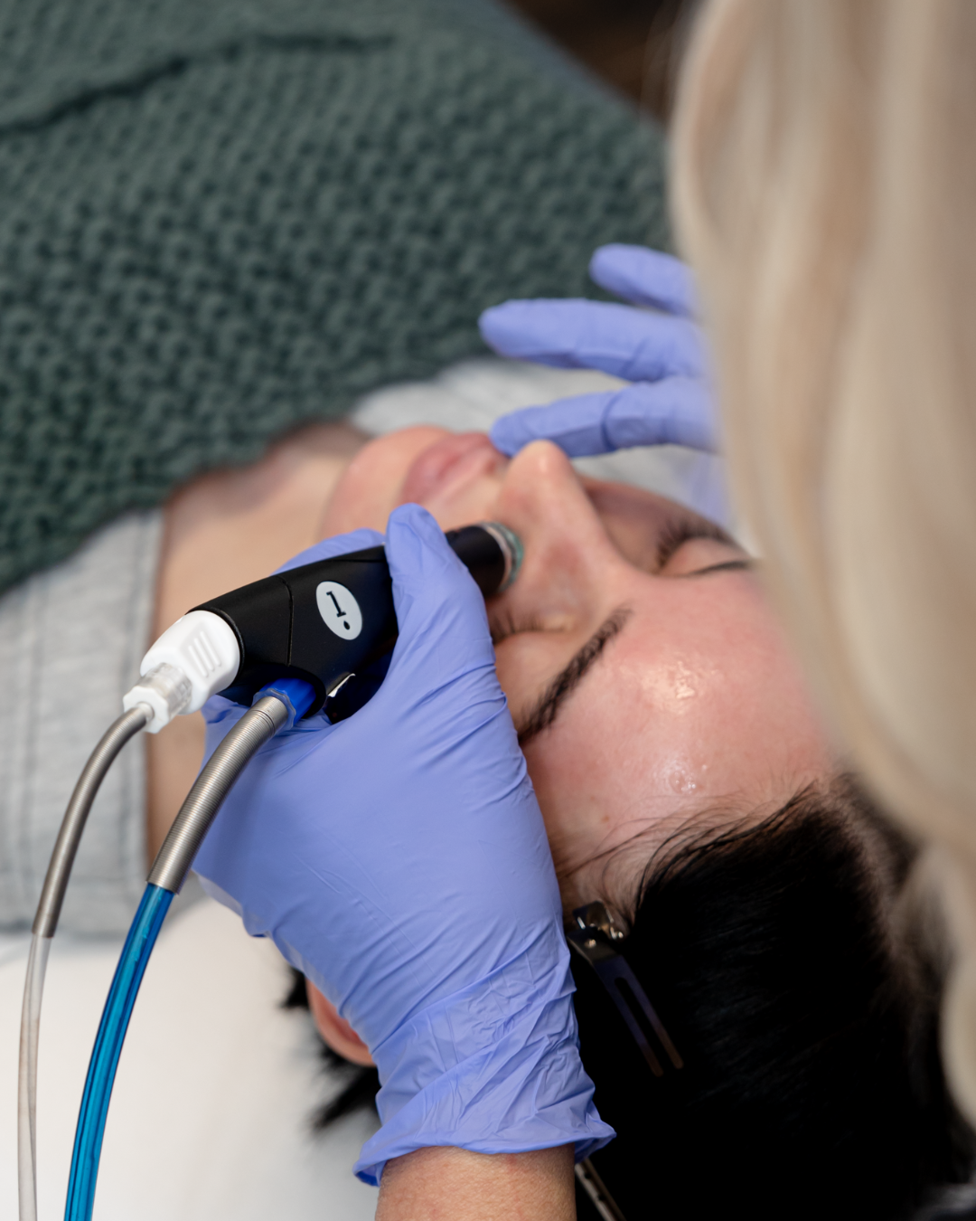 HydraFacial Deluxe Single Treatment
