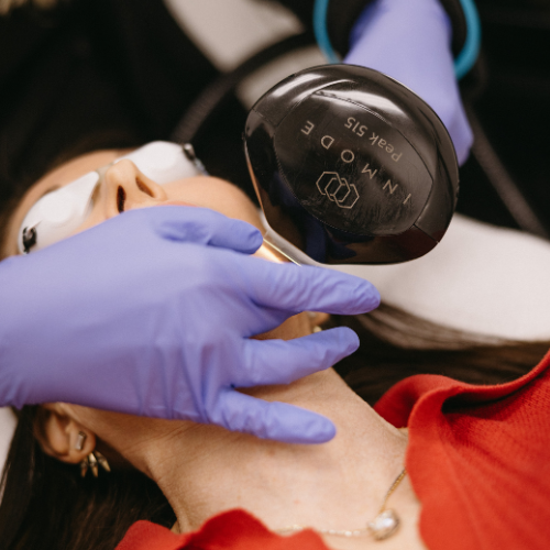 IPL PhotoFacial Single Treatment