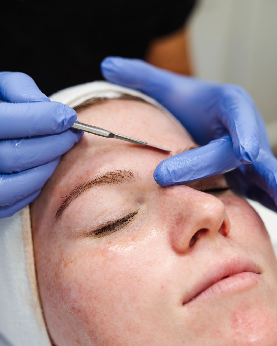 Dermaplaning Single Treatment