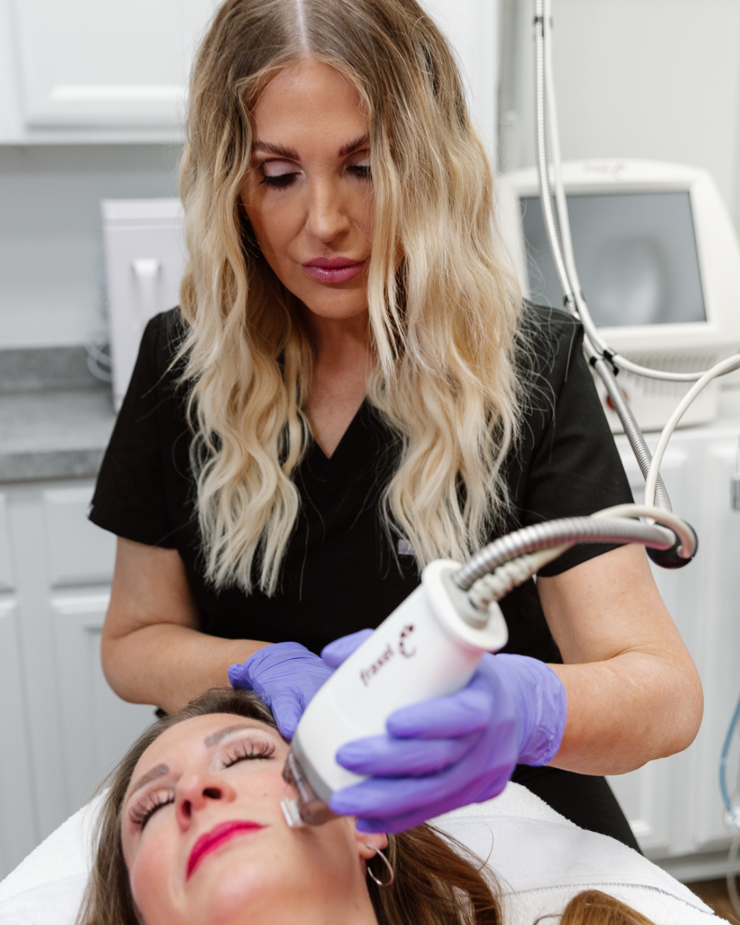 Fraxel Spot Treatment
