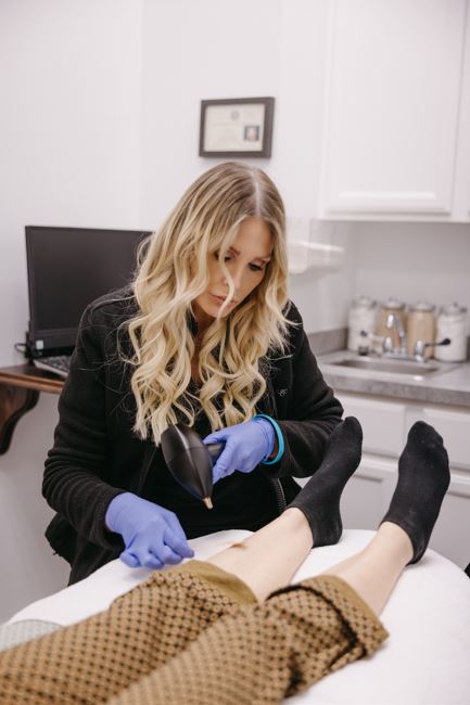 Vasculaze Large Area Package of 3 Treatments