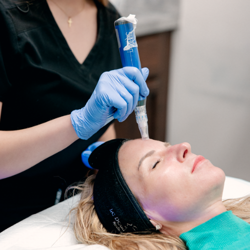 SkinPen Single Treatment